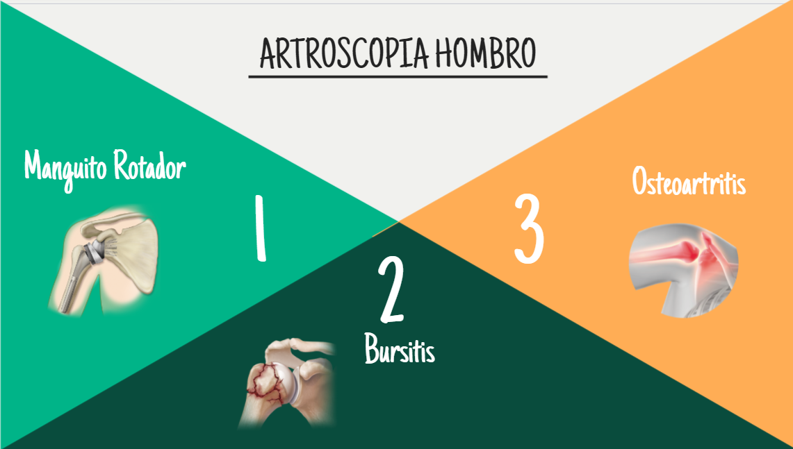 artroscopia en hombro