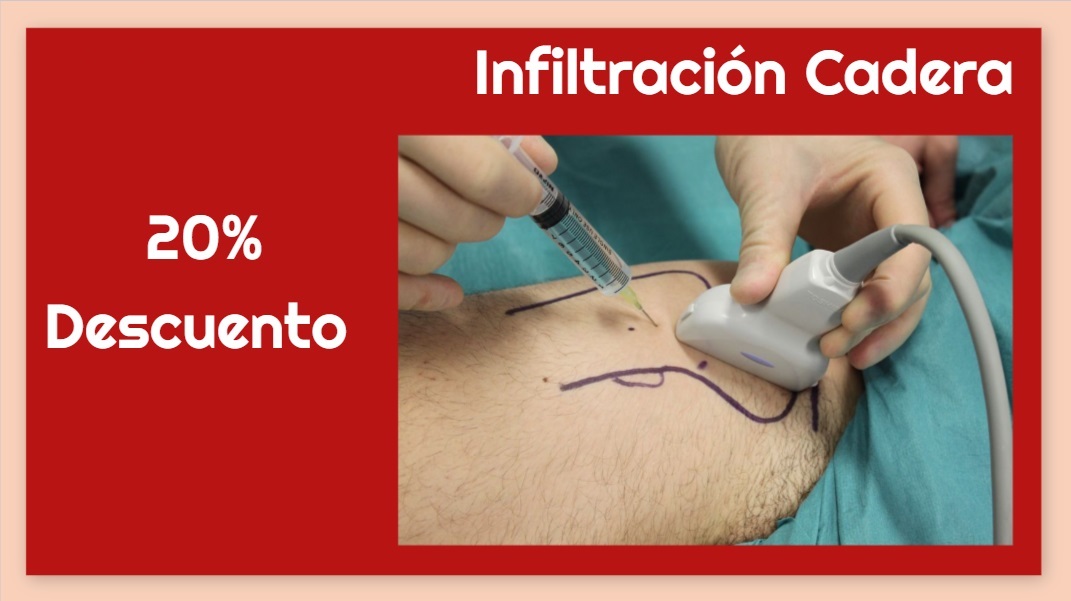 artroscopia en cadera